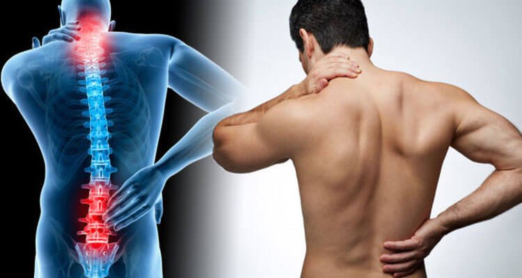 Lumbar Spondylosis
